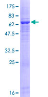 12.5% SDS-PAGE Stained with Coomassie Blue.